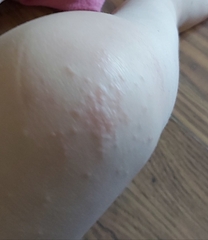 Whats this on DD's knees?