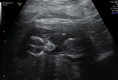 Thread for us classed as mature pregnant ladies