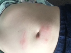 Can anyone help identify these bites