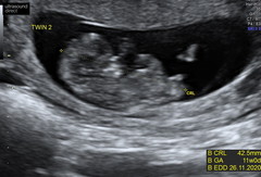 Due end of November Early December 👣