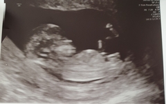 Thread for us classed as mature pregnant ladies