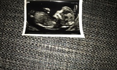 Boy or girl please guess 💜💙