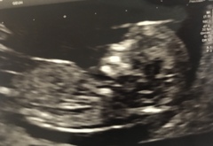 Anyone want to guess boy or girl ? 🥰❤️