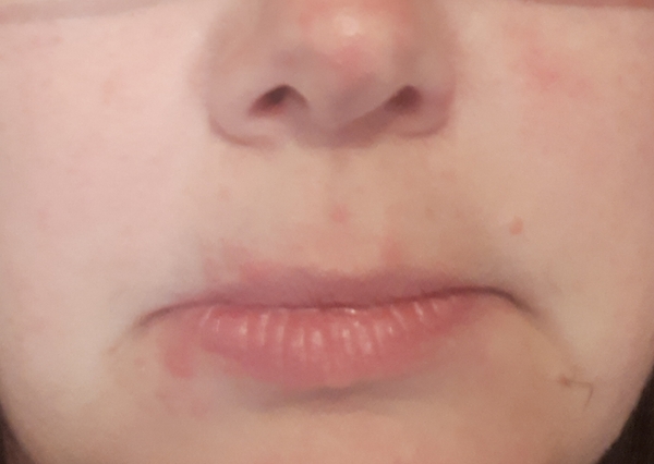 What could be going on with my skin?
