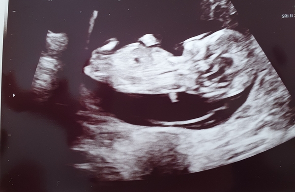 Christmas babies thread 3!