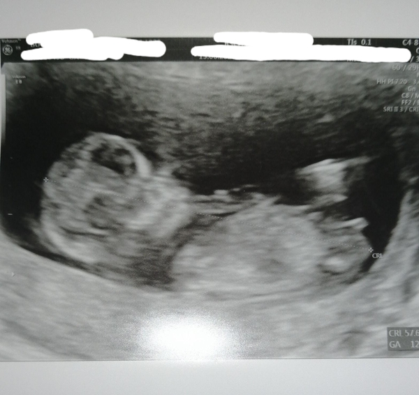Christmas babies thread 3!