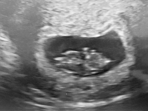 The May Group Graduates. RING HOOP BULLET.