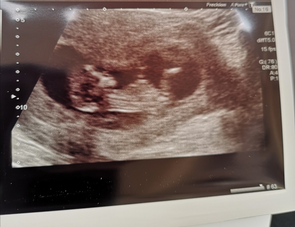 Christmas babies thread 3!