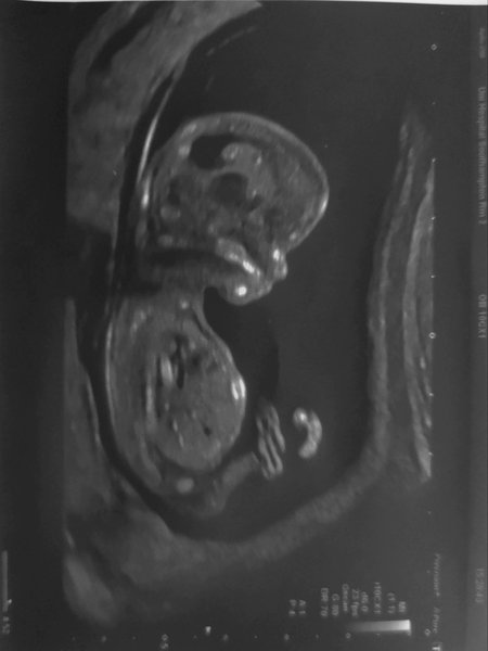 Christmas babies thread 3!