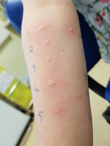 Can you mix two hay fever drugs?