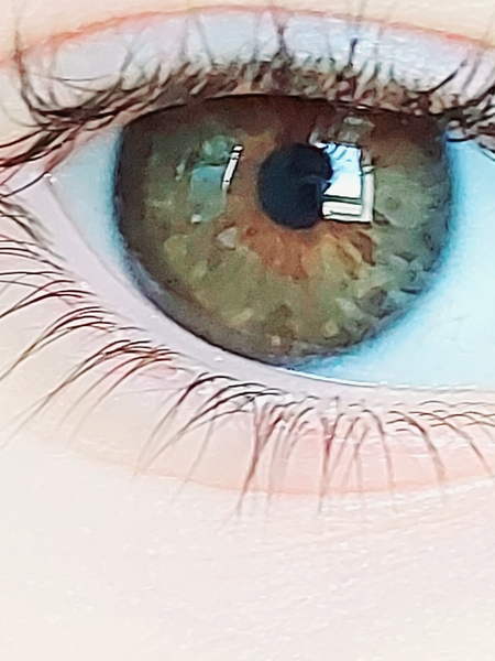 Eye colour