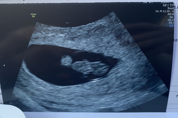 Window the the Womb - what to expect?