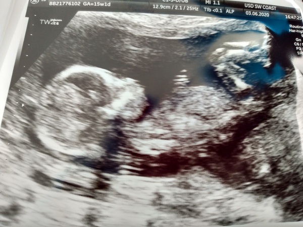 👣 Due Late Nov/Early Dec it's bump time! 👣