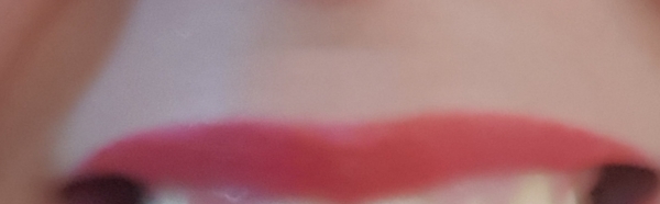 To feel sorry for woman who believe their lip fillers make them more attractive??