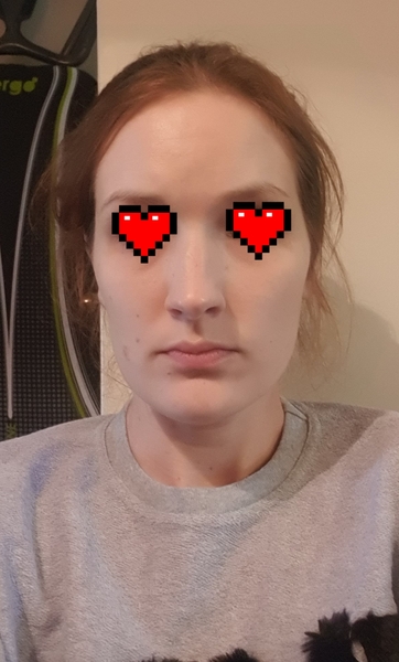 Help me improve my face (pic attached)