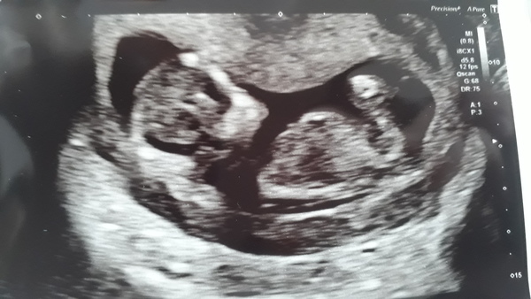 Christmas babies thread 3!