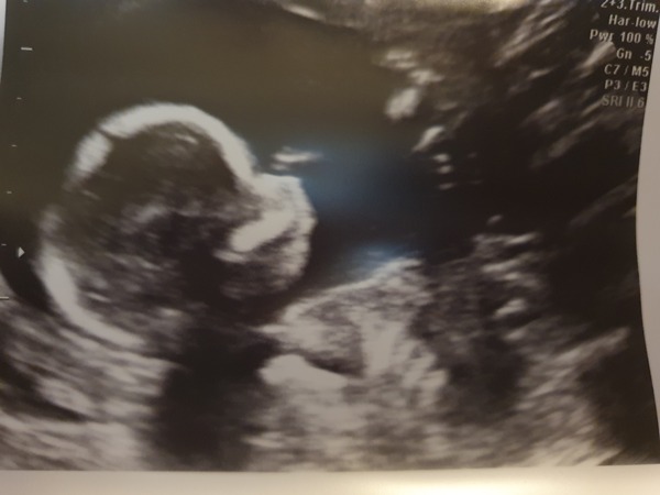 👣 Due late Nov/Dec, it's bump time ladies! 👣
