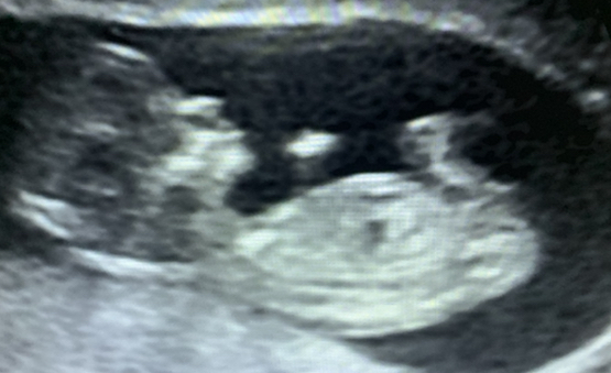 Christmas babies thread 3!