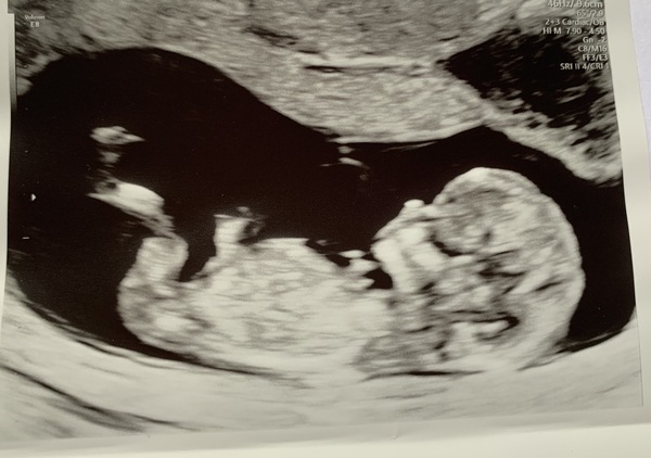 Christmas babies thread 3!