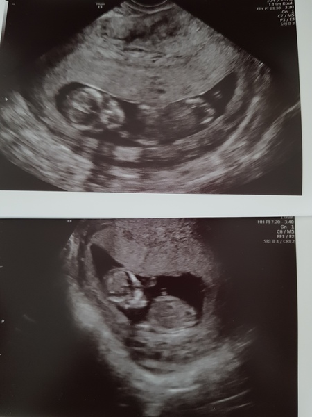 Guesses on the sex? Front facing pics