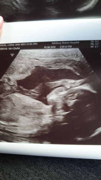 Early Oct babies part 5
