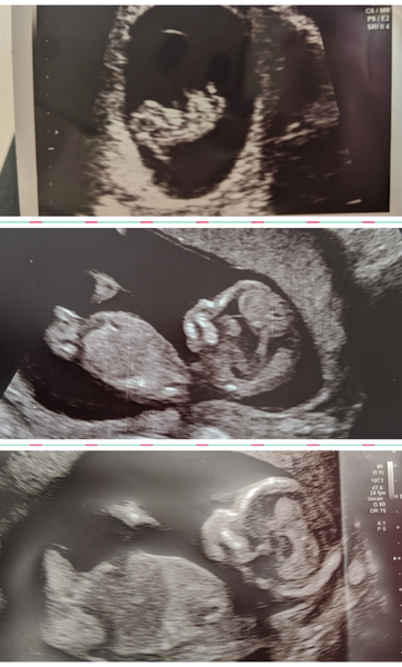 Christmas babies thread 4!