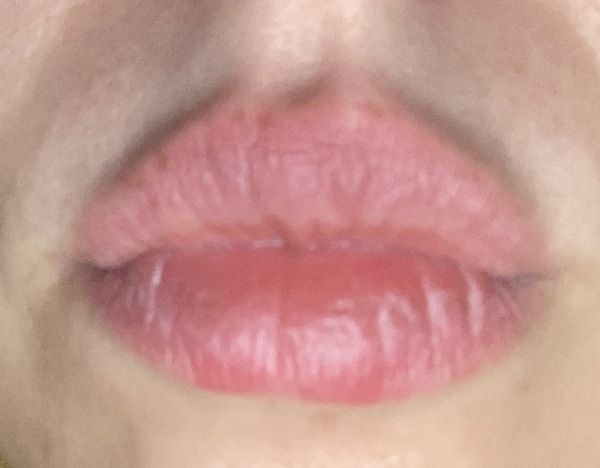 To think you can’t/tell if these lips have fillers? Photo attached