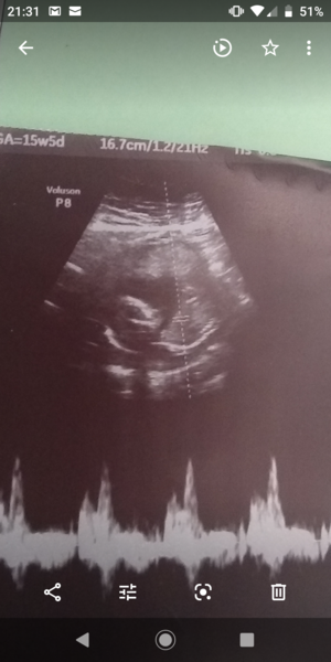 Boy or girl jus for fun