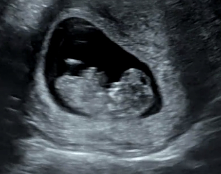 Jan/Feb 2021