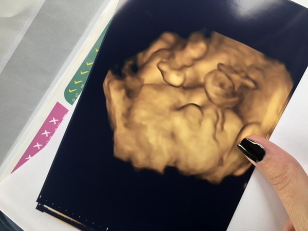 3/4D scans