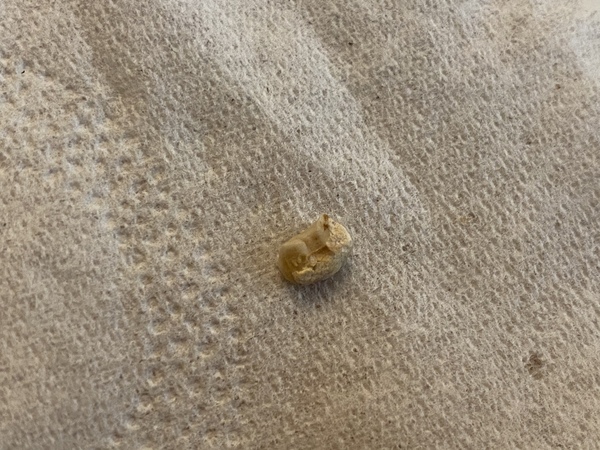 Broken Tooth - help!