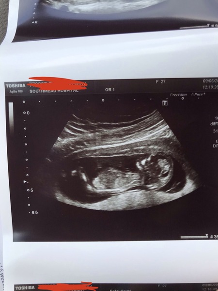 Boy or girl???? What do you think? 💙💗