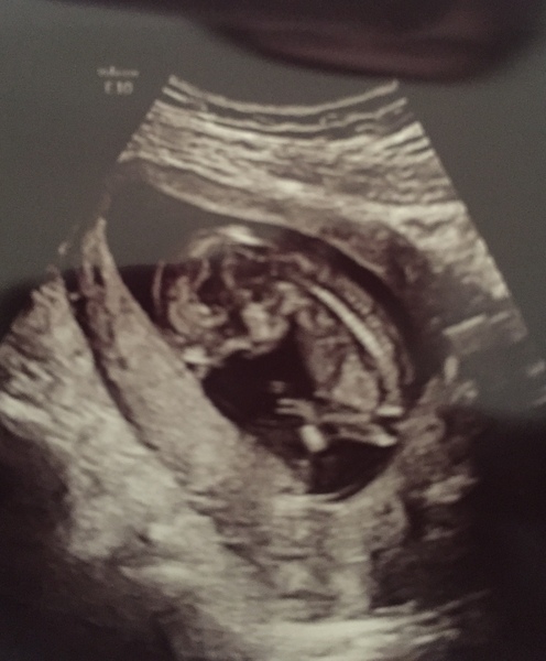 Christmas babies thread 3!