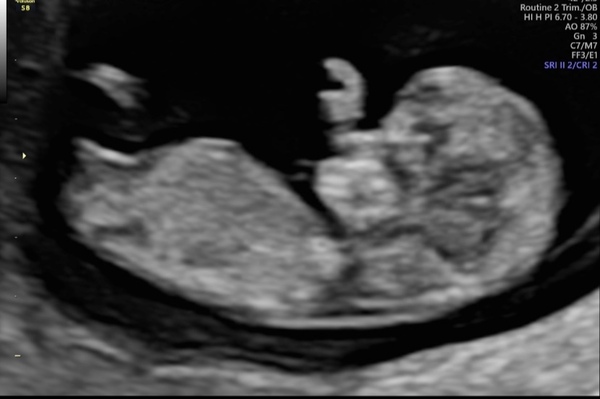 January 2021 due date- bus 3!
