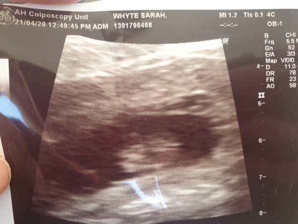 Am I too fat for a scan?!