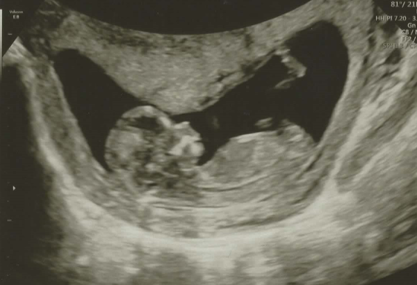 Christmas babies thread 3!