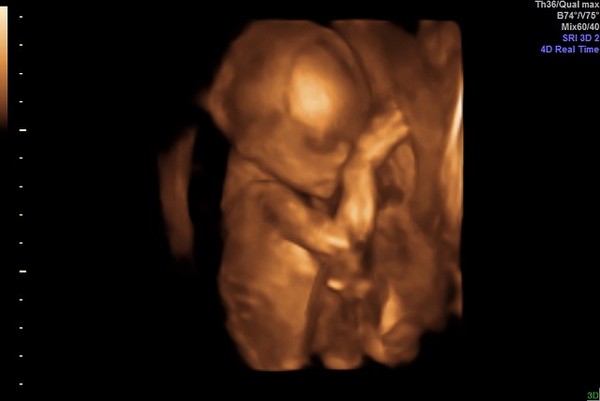 👣 Due late Nov/Dec, it's bump time ladies! 👣