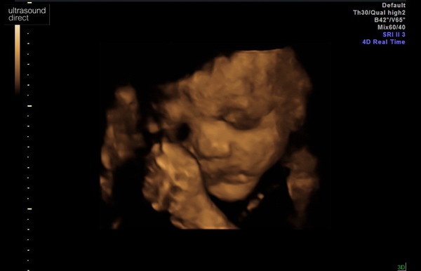3/4D scans