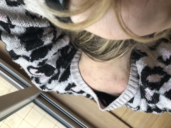 To ask if anyone has advice about an itchy head/neck (with pic)