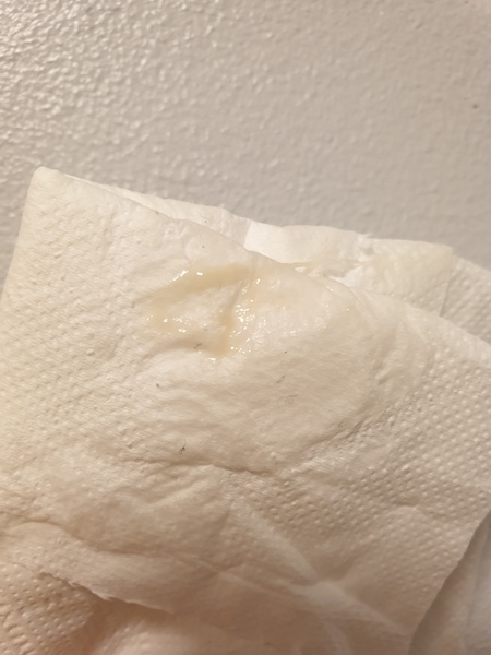 TMI is this normal for early pregnancy?