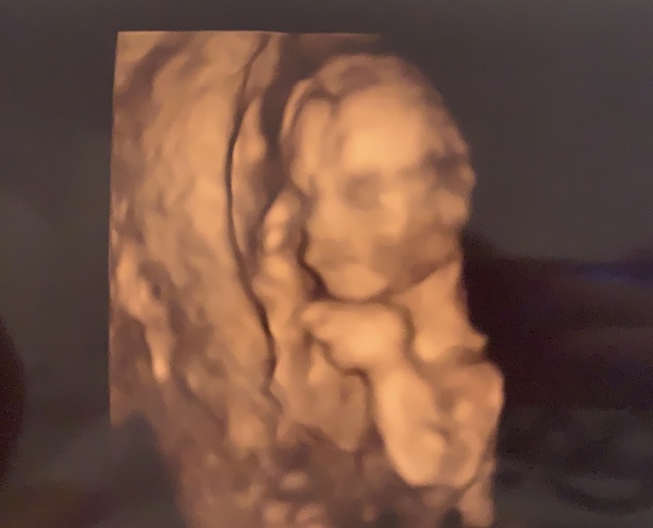 👣 Due Late Nov/Early Dec it's bump time! 👣