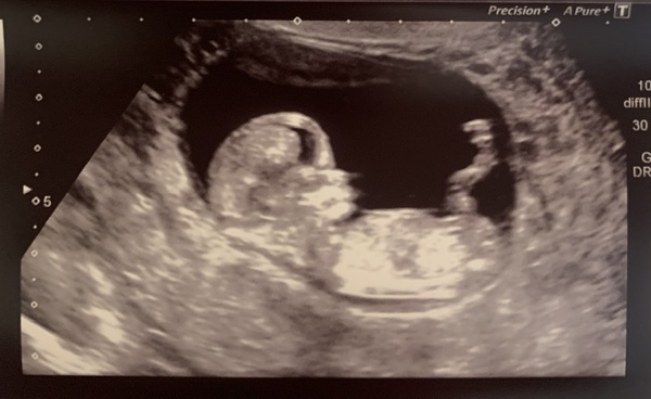 Christmas babies thread 3!