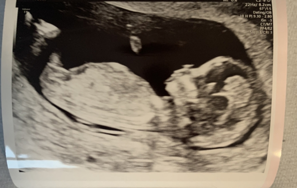 2020 baby