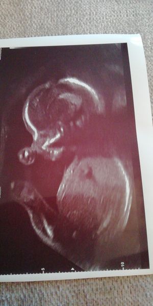 November 2020 babies - thread 7!