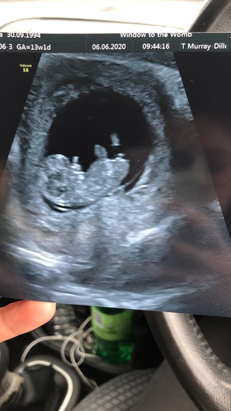 Boy or girl?