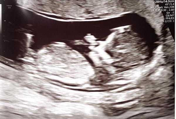 Christmas babies thread 3!