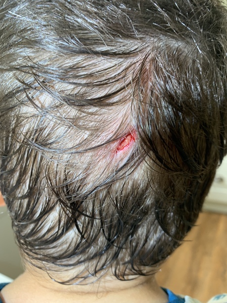 Does this need a stitch/A&E?