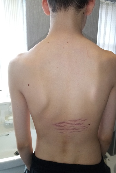 What on earth is this that has appeared on Ds 13 back?