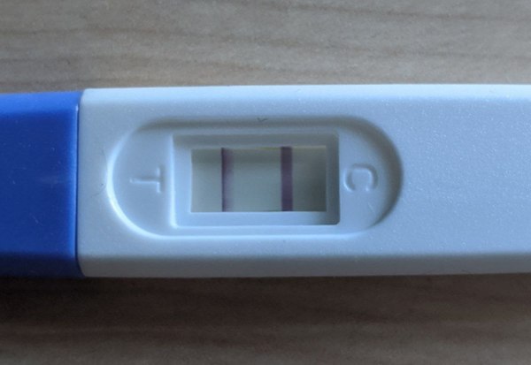 No symptoms & AF late