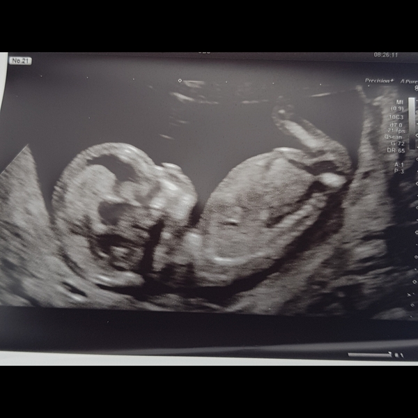 January 2021 due date- bus 3!